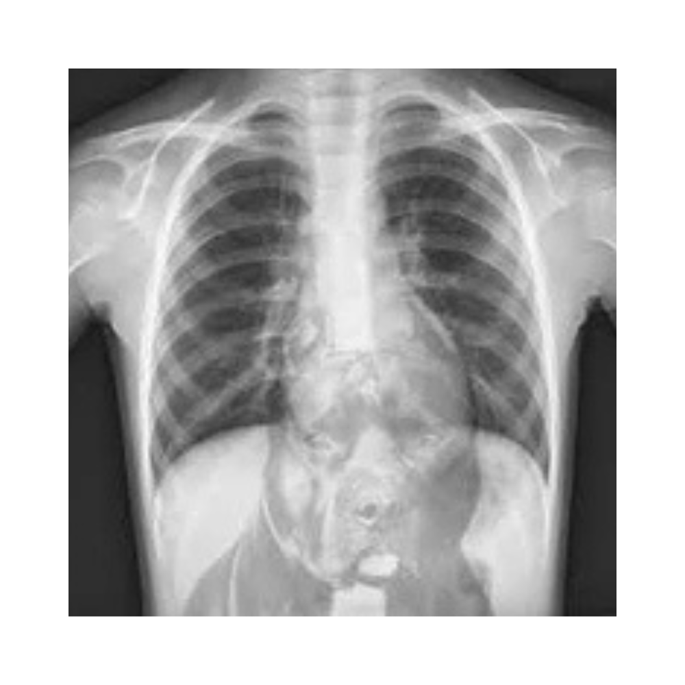 Frog Grips – Patch Pete Bulldawg – Peter Ellis